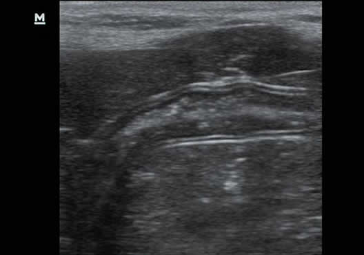 KZ60Vet Color Doppler | Veterinary Ultrasounds