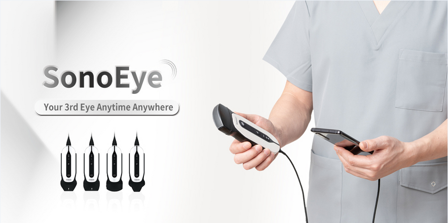 Chison SonoEye P3 VET Phased Array | Handheld Veterinary Ultrasounds