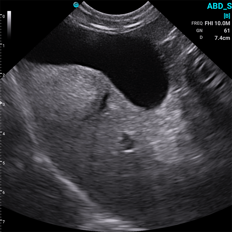 Chison SonoEye VET Handheld Mobile Phone Ultrasound | Veterinary Ultrasounds