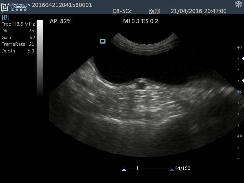 iuStat 100Vet Black & White Veterinary Ultrasound