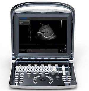 Chison ECO1Vet Veterinary Ultrasound Machine Used