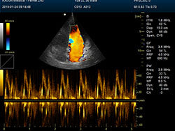 DCU30Vet Color Doppler Ultrasound | Veterinary Ultrasounds