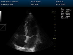 DCU30Vet Color Doppler Ultrasound | Veterinary Ultrasounds