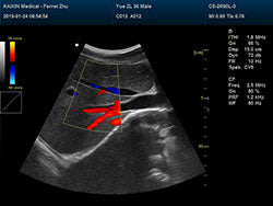 DCU30Vet Color Doppler Ultrasound | Veterinary Ultrasounds