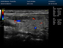 DCU30Vet Color Doppler Ultrasound | Veterinary Ultrasounds