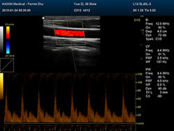 DCU30Vet Color Doppler Ultrasound | Veterinary Ultrasounds