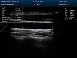 DCU30Vet Color Doppler Ultrasound | Veterinary Ultrasounds