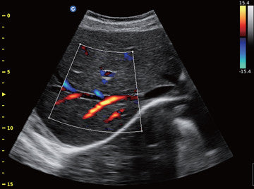 Chison ECO6VET | Veterinary Ultrasounds