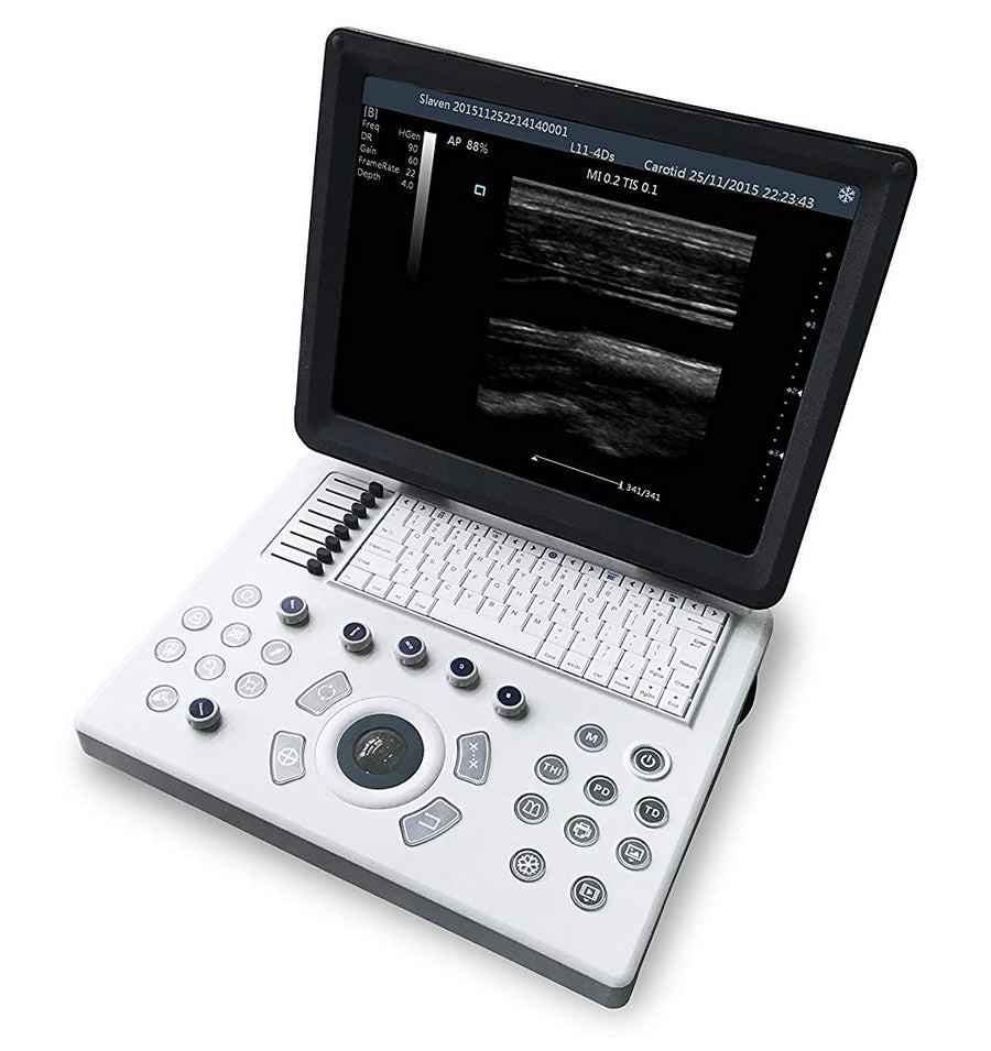 iuStar100Vet Black & White Laptop Ultrasound Machine For Veterinary