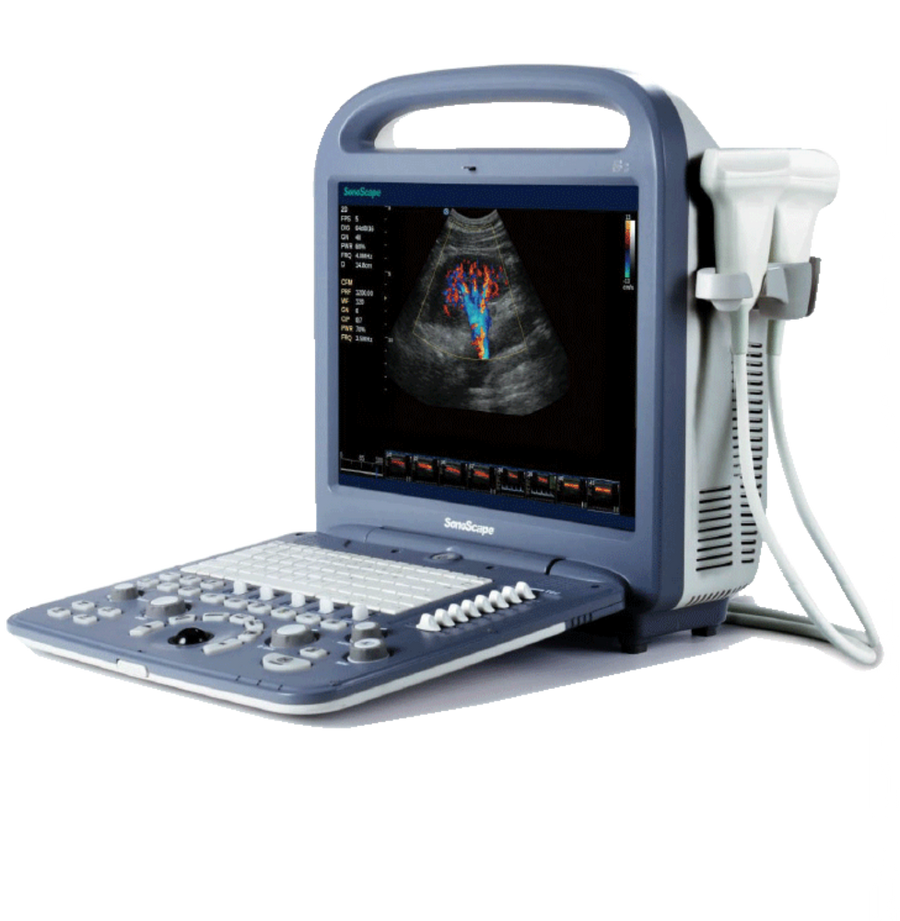 SonoScape S2V Ultrasound - Deals on Veterinary Ultrasounds
 - 1