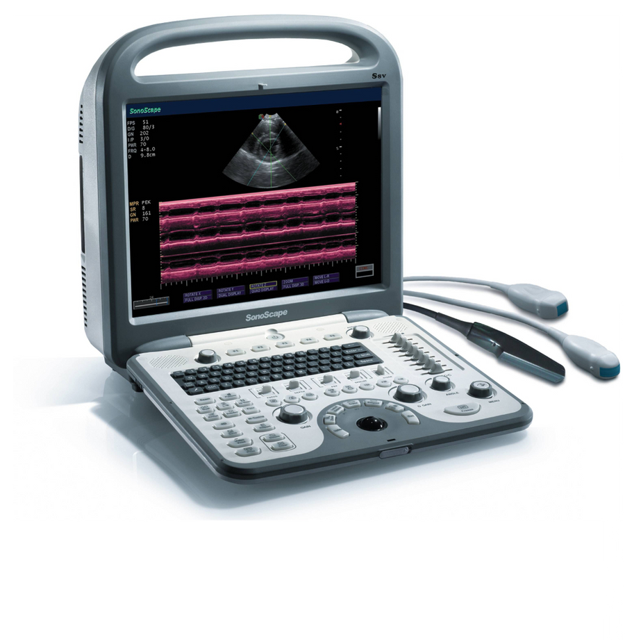 SonoScape S8V Ultrasound - Deals on Veterinary Ultrasounds
