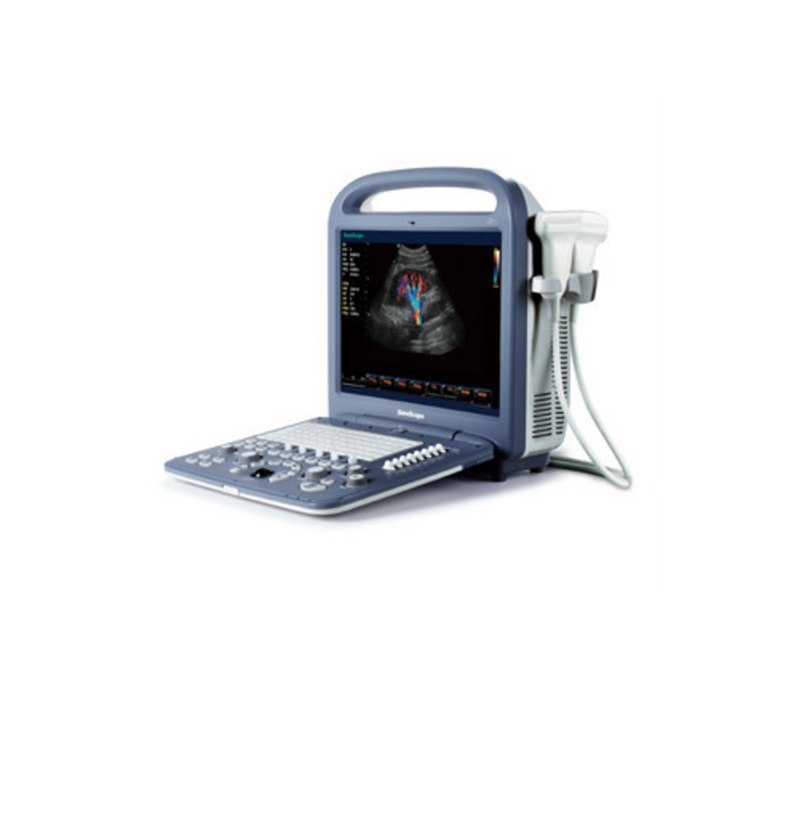 Used Sonoscape S2V Ultrasound - Deals on Veterinary Ultrasounds
 - 1